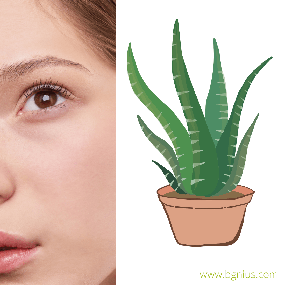 Aloe vera for sunburn